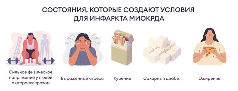 Инфаркт миокарда