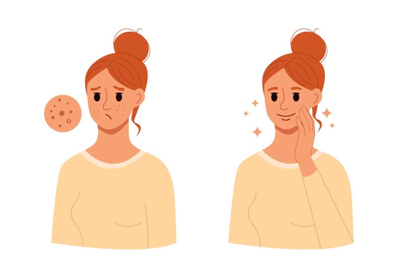 Угревая сыпь