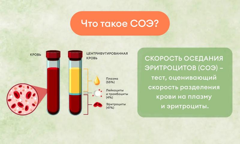 Что такое соэ