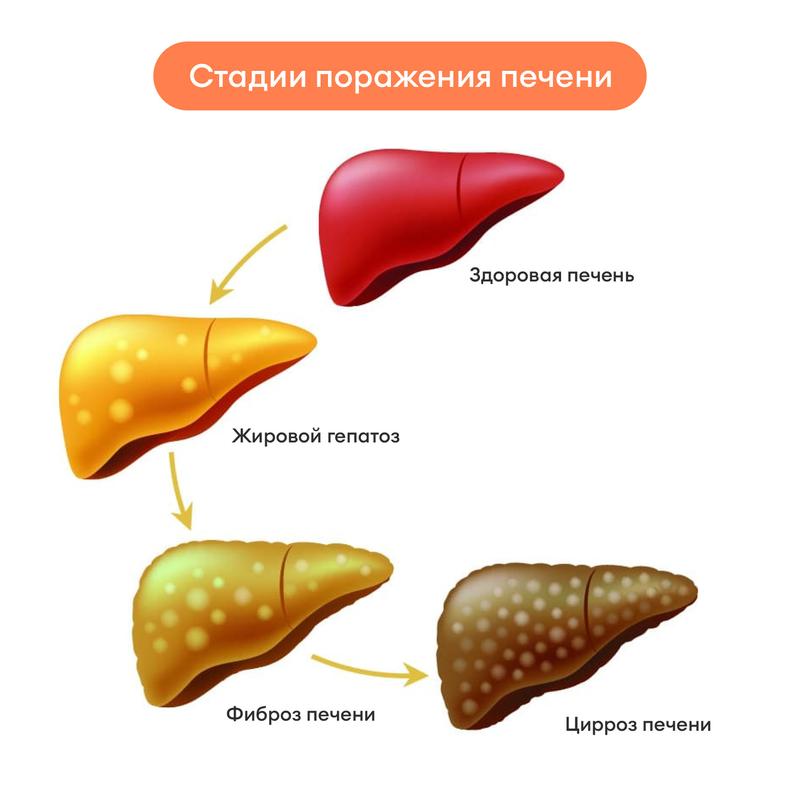 симптомы больной печени