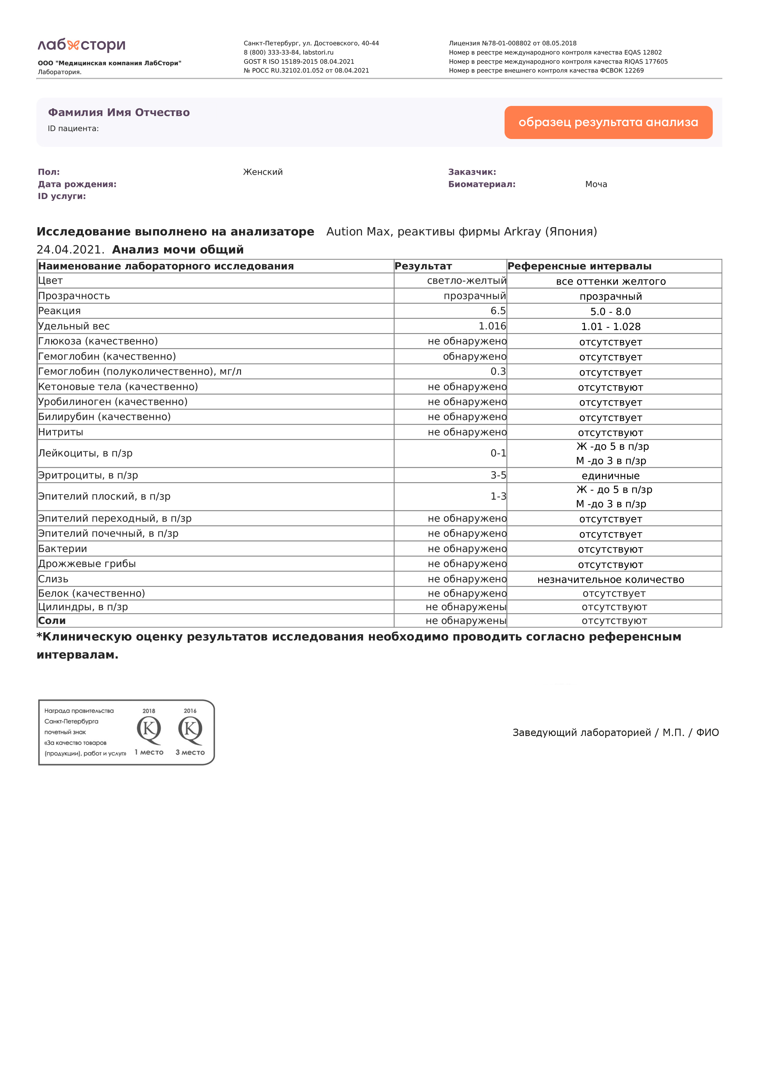 Анализ мочи общий в Смоленске