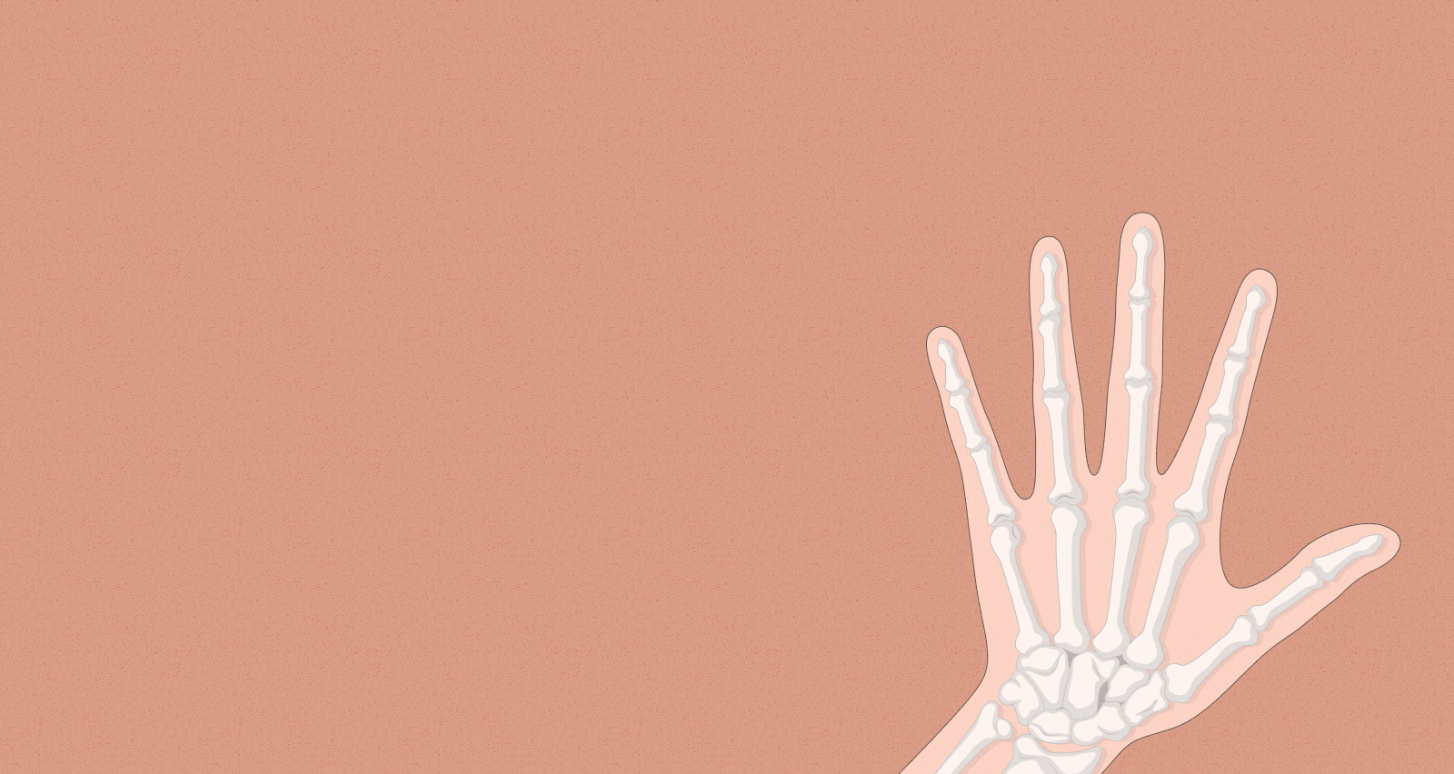 Миеломная болезнь - что это, диагностика, симптомы, причины и анализы ...