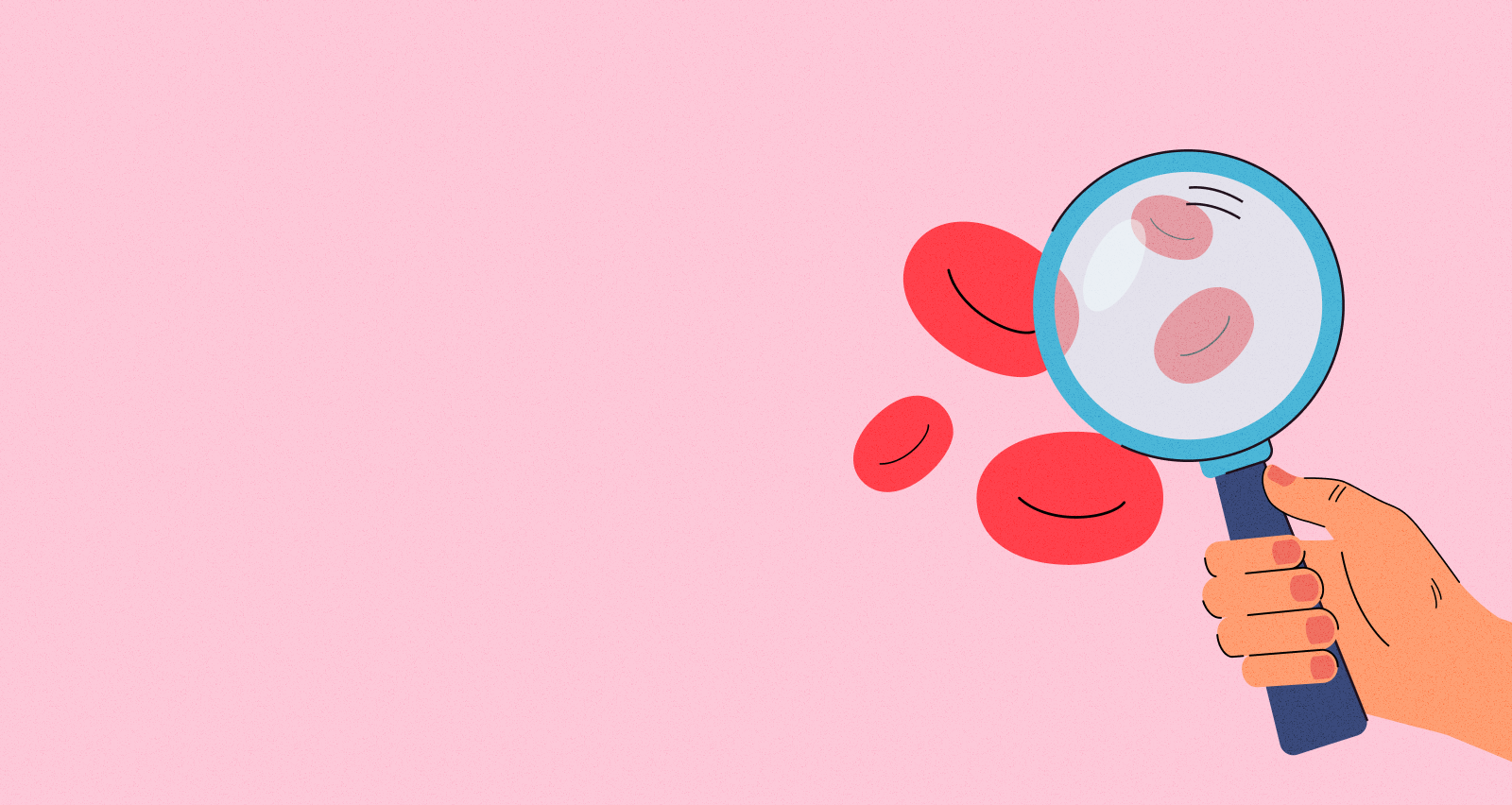 Железодефицитная анемия (ЖДА) – что это такое: признаки и причины ...